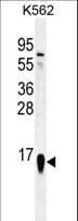 RPS19 / Ribosomal Protein S19 Antibody (aa25-54)