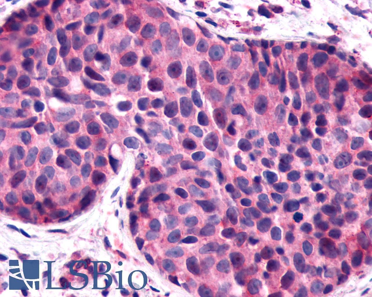 PathPlus™ Polyclonal Rabbit anti-Human F2RL1 / PAR2 Antibody (C-Terminus, IHC)