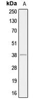 AHSA1 / AHA1 Antibody (Internal)