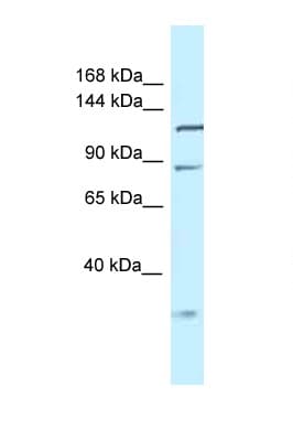 TMEM132D Antibody (aa700-749)