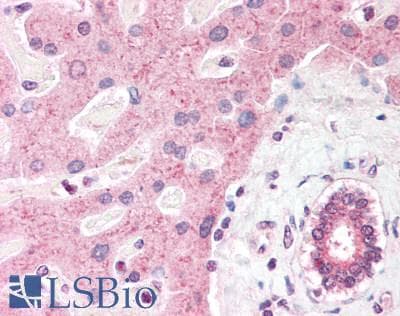 TET2 Antibody