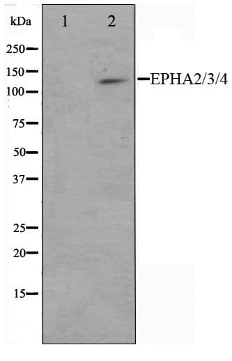 Polyclonal Rabbit anti-Human EPH Receptor A2+A3+A4 Antibody (IF, WB)