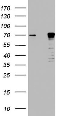 PathPlus™ MTDH / Metadherin Antibody (aa70-582, clone OTI1E7)