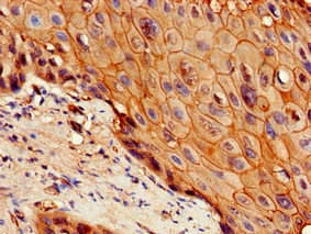 IL7R / CD127 Antibody