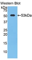 CTSK / Cathepsin K Antibody (aa90-318)