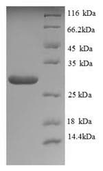 Saccharomyces cerevisiae Neutral Trehalase Protein (Recombinant 6His, N-terminus)