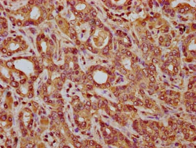 Polyclonal Rabbit anti-Human C14orf177 Antibody (IHC)