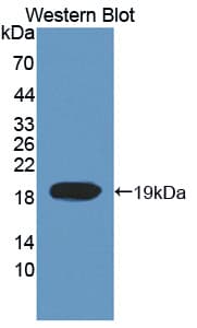 Polyclonal Rabbit anti-Human TOP3A Antibody (Biotin, aa35-179, WB)
