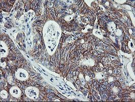 ERBB2 / HER2 Antibody (aa676-1255, clone OTI4F10, Carrier-free)
