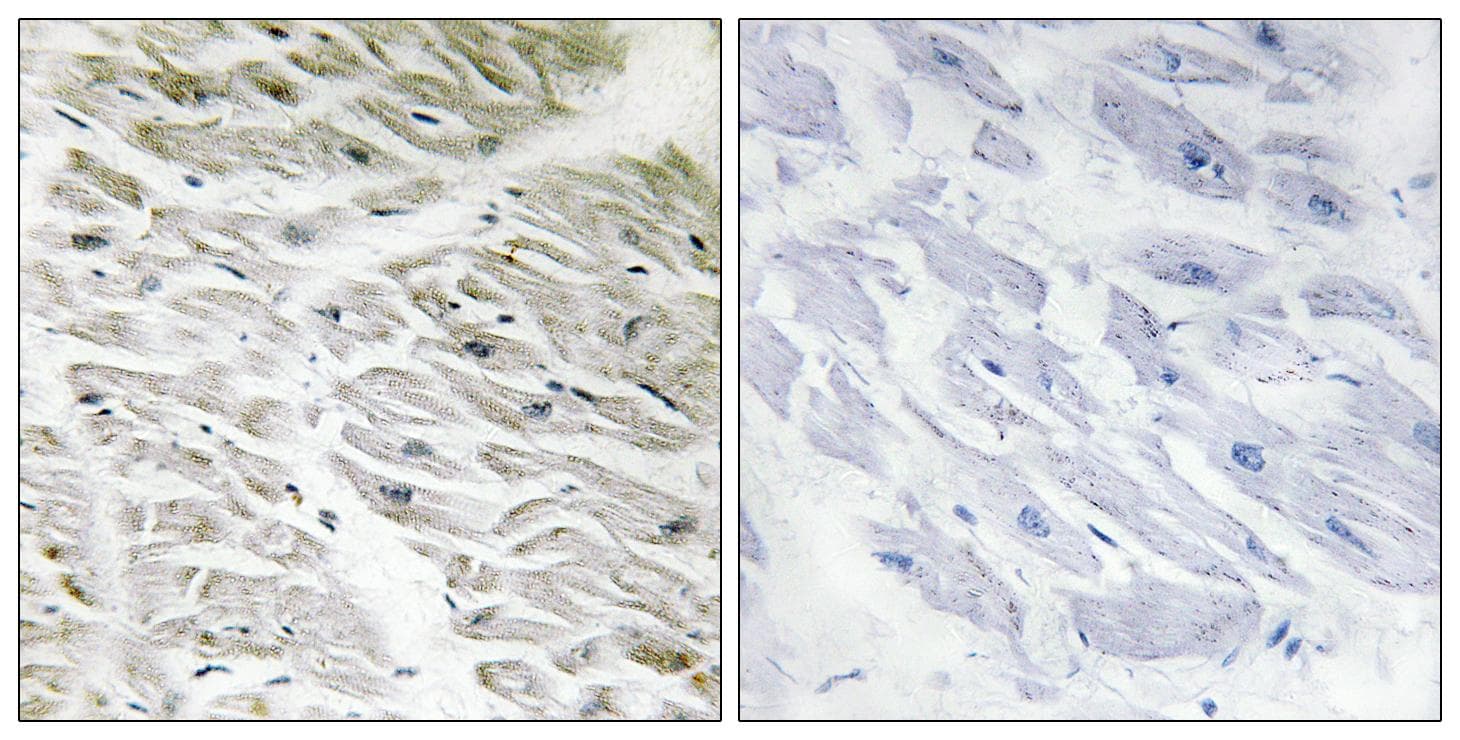 PPP1R14A / CPI-17 Antibody (p38)