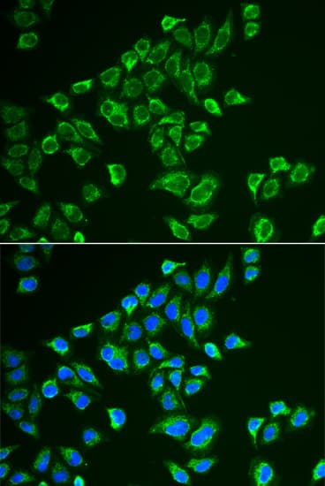 PathPlus™ Polyclonal Rabbit anti-Human TAC3 / Tachykinin Antibody (IHC, IF, WB)