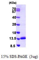 Human SNRPE Protein (Recombinant His)