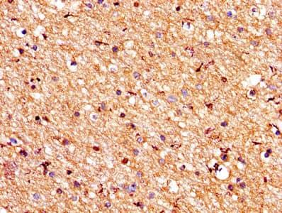 PROS1 / Protein S Antibody (aa42-676)