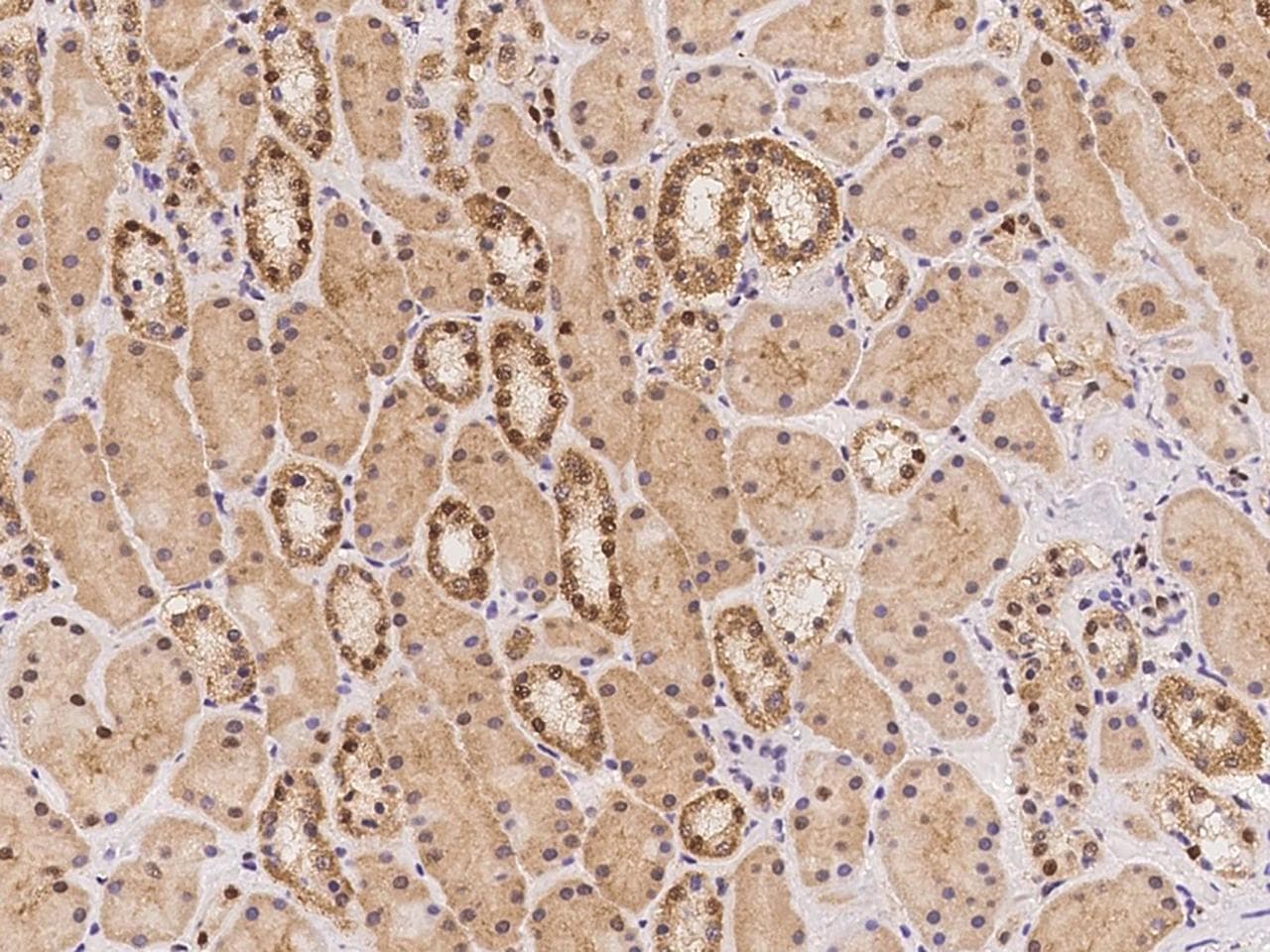 Polyclonal Rabbit anti-Human RGS22 Antibody (IHC)