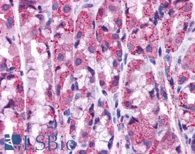 PathPlus™ Polyclonal Rabbit anti-Human HRH1 / Histamine H1 Receptor Antibody (Extracellular Domain, IHC)