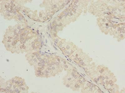Polyclonal Rabbit anti-Human TTC38 Antibody (IHC, WB)