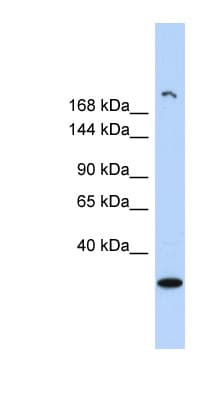 Polyclonal Rabbit anti-Human UTY Antibody (aa971-1020, WB)