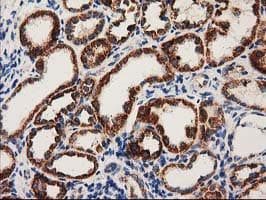 MMAB Antibody (clone OTI2G5, Carrier-free)