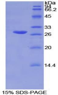 Mouse GSTM2 Protein (Recombinant His-T7)