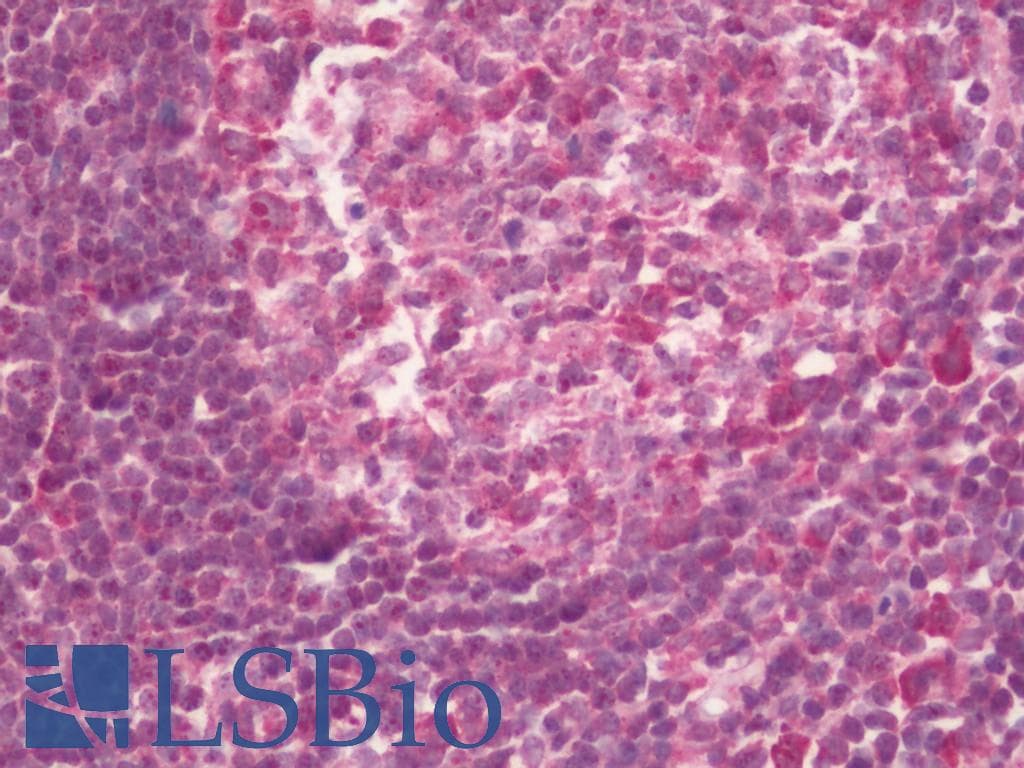 IHC-plus™ TARSH / ABI3BP Antibody