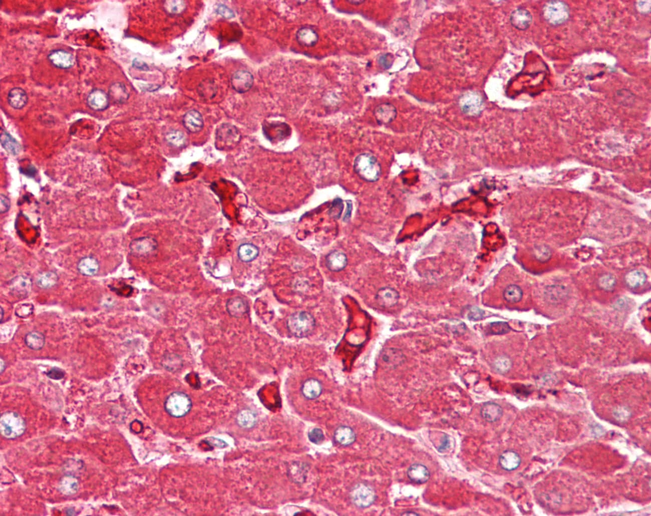 PathPlus™ Polyclonal Rabbit anti-Human FTL / Ferritin Light Chain Antibody (C-Terminus, IHC, WB)