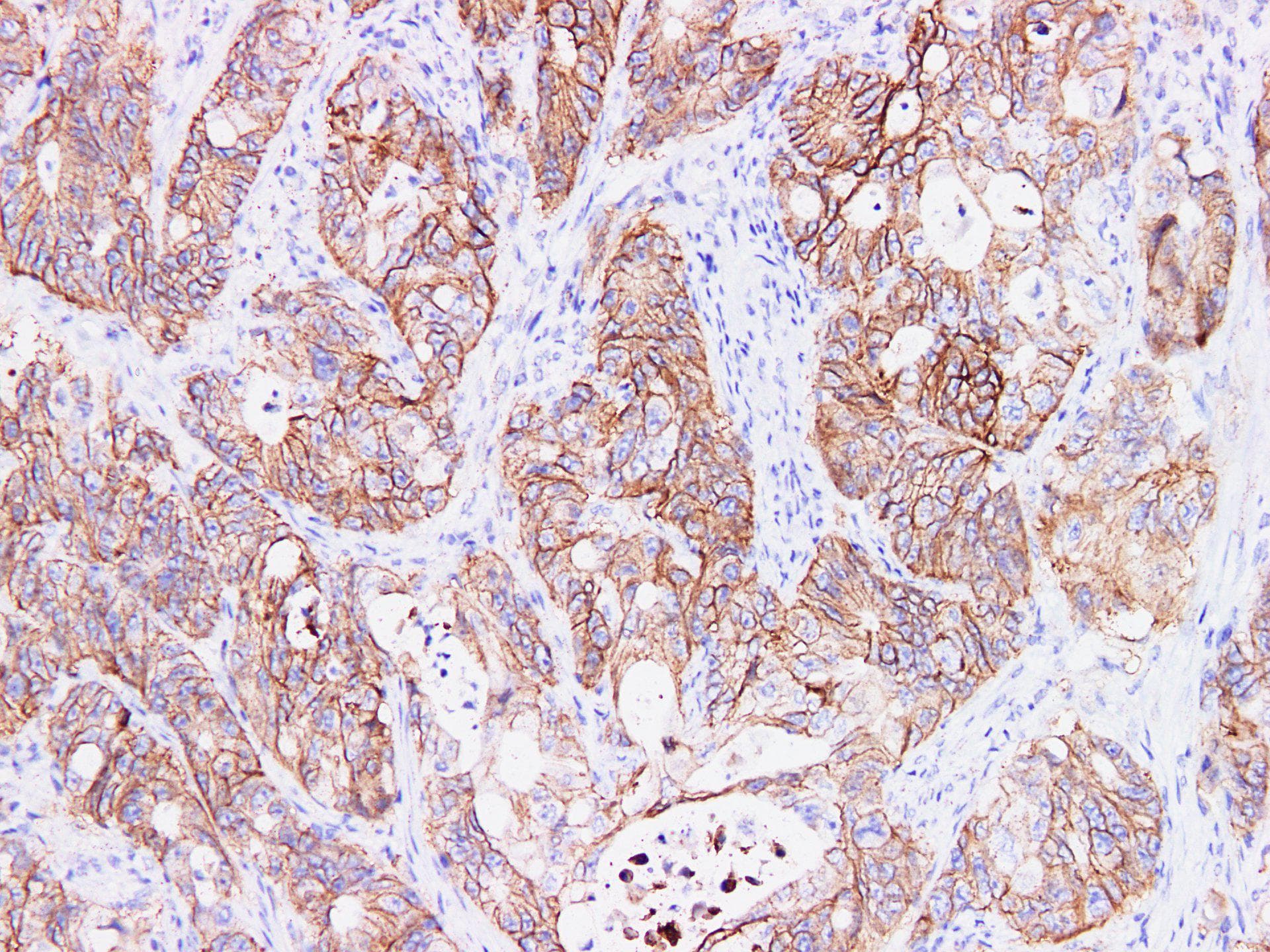 EPCAM Antibody