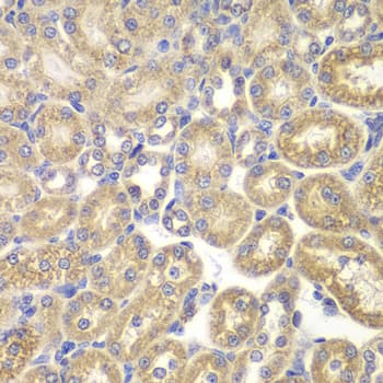 PSMD9 / 26S Proteasome Antibody