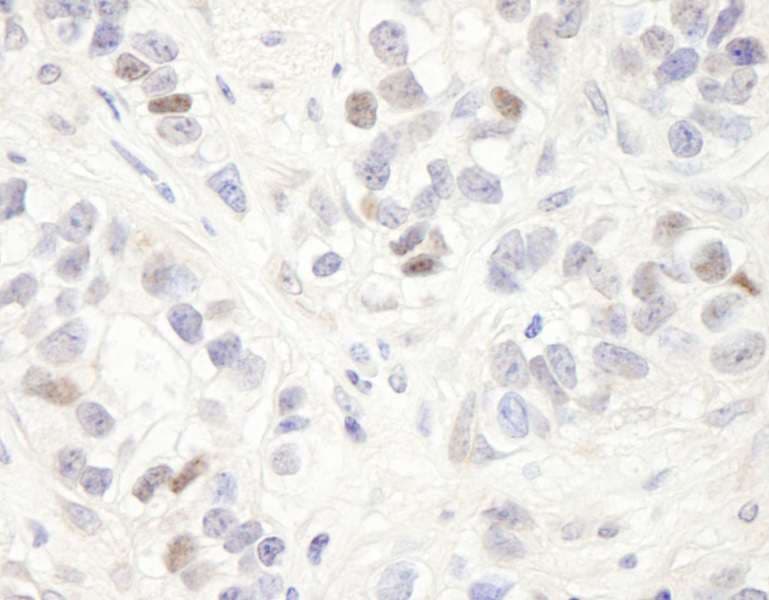 MAGED2 Antibody (aa1-50)