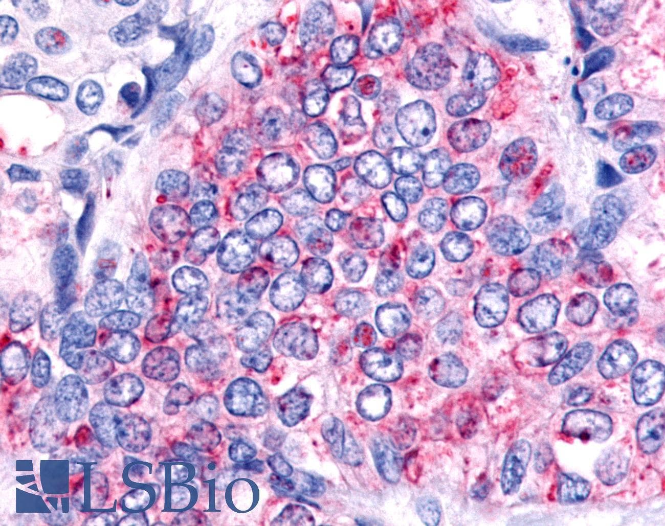 PathPlus™ HNF4G / HNF4 Gamma Antibody (Ligand-binding Domain)