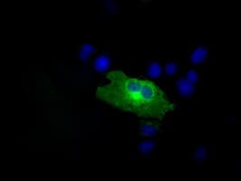 Monoclonal Mouse anti-Human RIP1 / RALBP1 Antibody (clone OTI11B2, IHC, IF, WB)