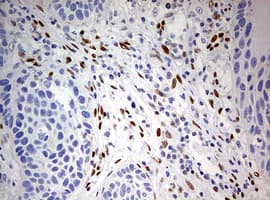 ZEB1 / AREB6 Antibody (aa1-350, clone OTI7E12)