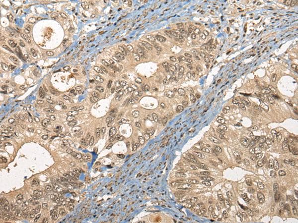 Polyclonal Rabbit anti-Human CC2D1A Antibody (IHC)