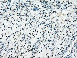 MAP2K4 / MKK4 Antibody (clone OTI1D6)