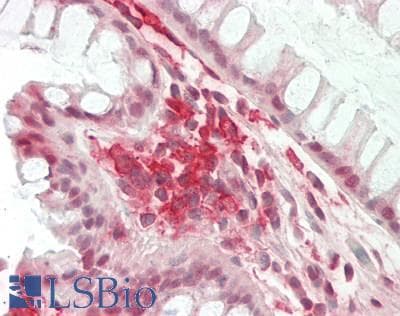 IHC-plus™ CD32A Antibody