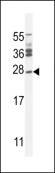 JOSD2 Antibody (aa33-61)