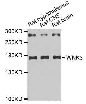 WNK3 / PRKWNK3 Antibody