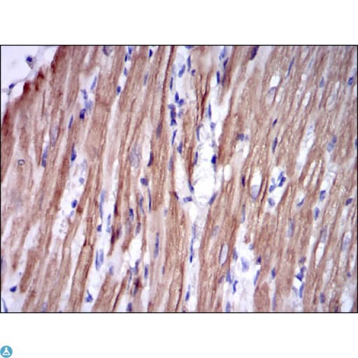TNNI2 Antibody