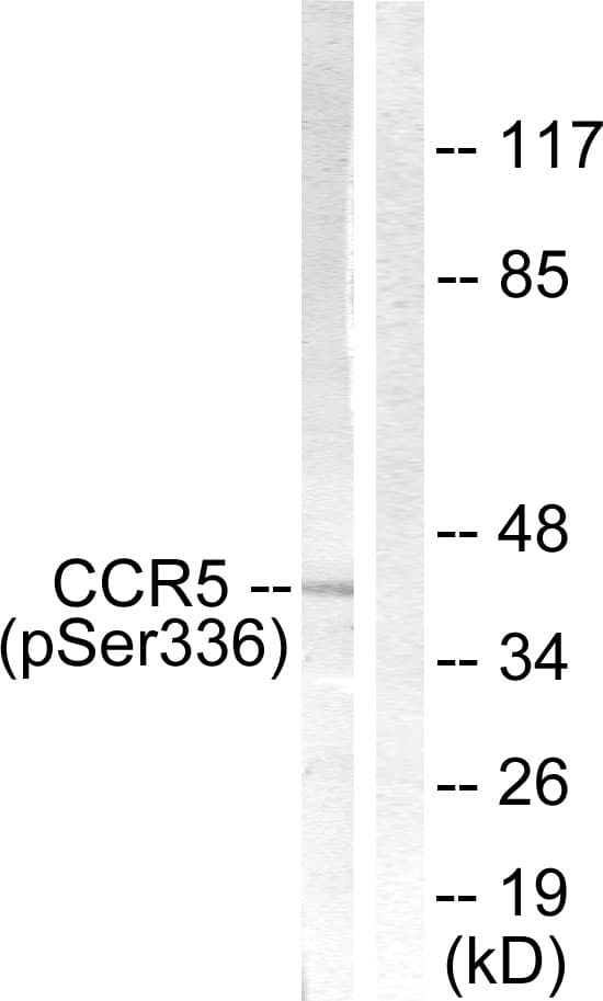 CCR5 Antibody (phospho-Ser336)
