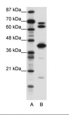 Polyclonal Rabbit anti-Human E2F2 Antibody (aa191-240, IHC, WB)