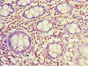 SDC1 / Syndecan 1 / CD138 Antibody (aa23-254, Biotin)