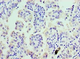 CLP / COTL1 Antibody (aa1-142)
