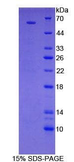 Human RPS6KB2 / S6K2 Protein (Recombinant His-GST)