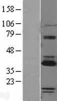 PARP16 Protein (Over-Expression Lysate Myc-DDK (Flag))