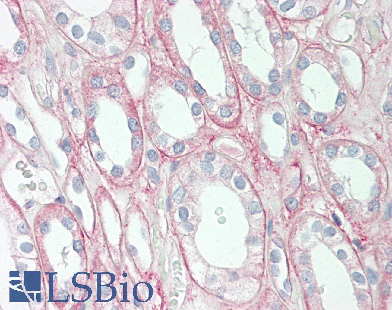 HPCAL1 / Hippocalcin-Like 1 Antibody (C-Terminus)