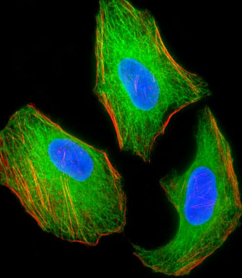IHC-plus™ Monoclonal Mouse anti-Mouse Tuberin / TSC2 Antibody (clone 249CT19.1.3, IHC, IF, WB)