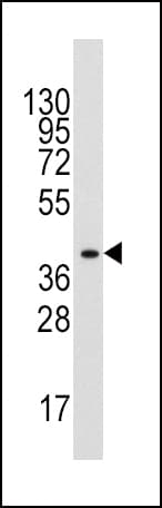 ALDOA / Aldolase A Antibody (aa303-331)