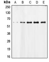 AIFM1 / AIF / PDCD8 Antibody (N-Terminus)