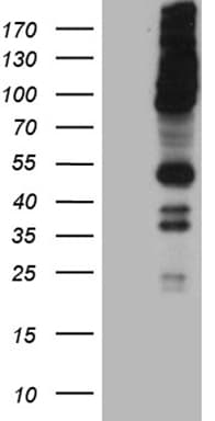 Monoclonal Mouse anti-Human RUSC2 Antibody (clone OTI1A1, aa1176-1516, WB)