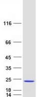 Human CPLX2 / Complexin 2 Protein (Recombinant Myc-DDK (Flag))