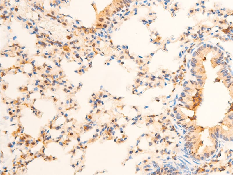 PDPK1 / PDK1 Antibody (phospho-Ser241)